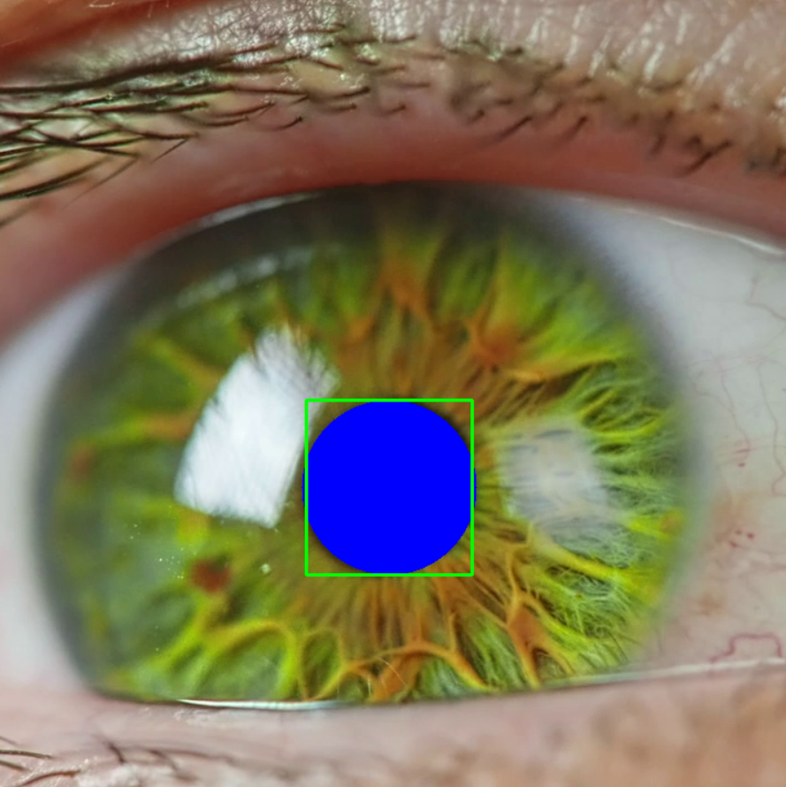 Concussion project image