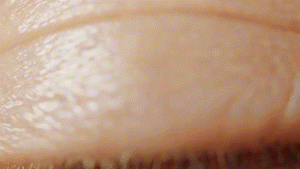 Gif of concussion algorithm